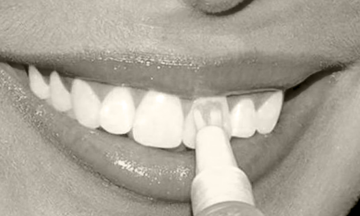 как отбелить зубы после курения