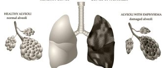 заболевания легких у курильщиков